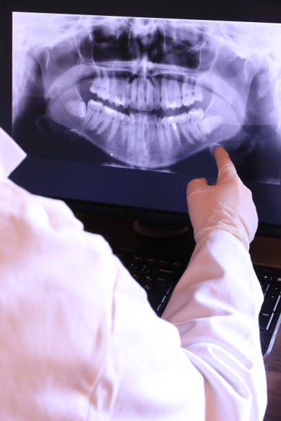 Best Emergency Tooth Extraction in Hendron, KY