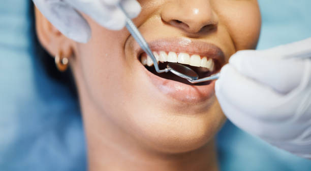Best Emergency Tooth Extraction in Hendron, KY
